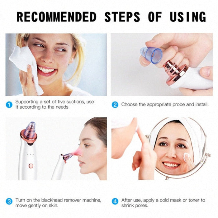 Electric Vacuum Blackhead Remover Device: white, silver handheld pore vacuum / blackhead remover device, modern cosmetic beau